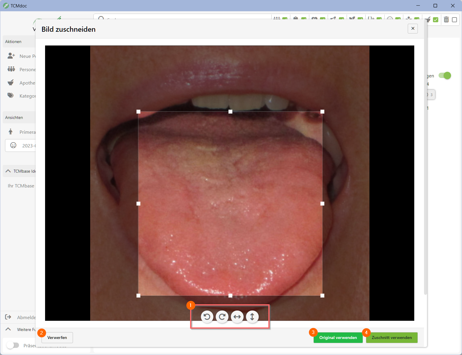 TCMdoc Zungenbild zuschneiden