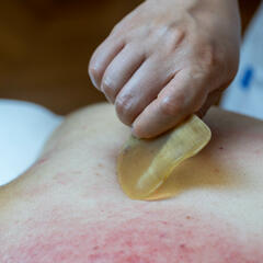 Yang Shen, Gua sha