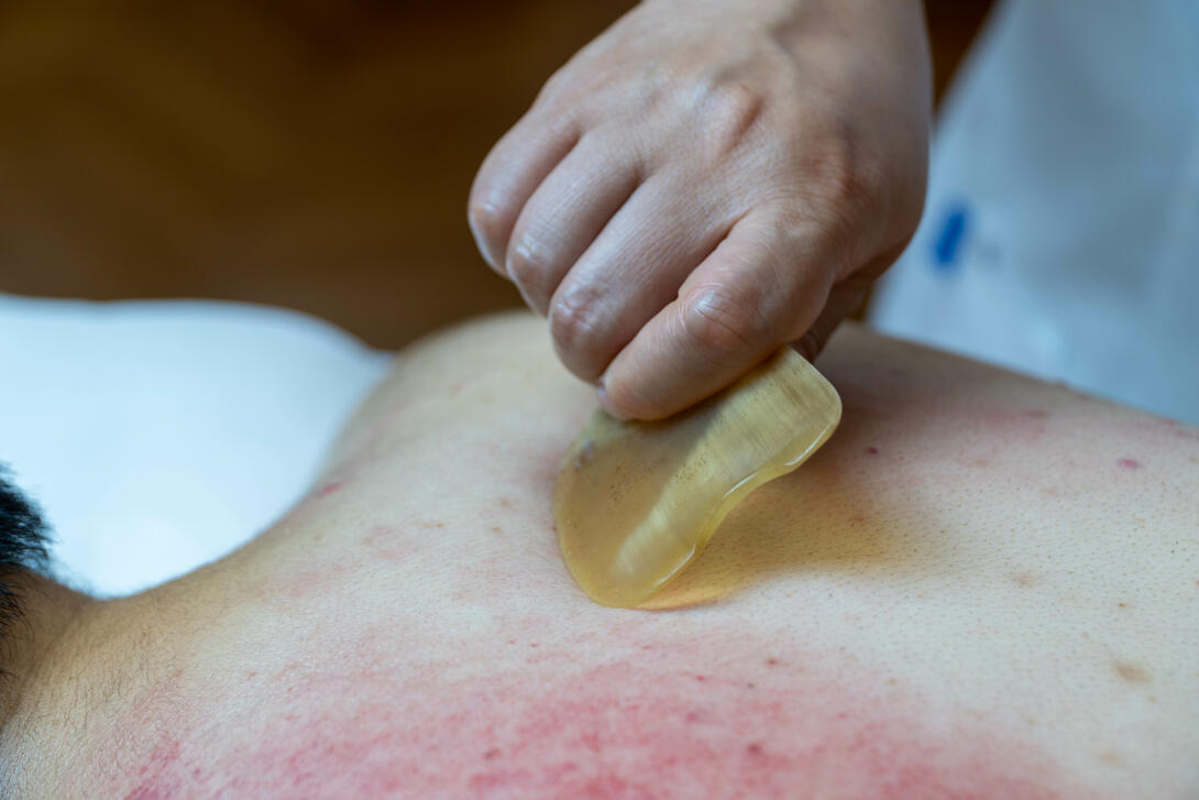 Yang Shen, Gua sha
